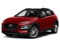 2018 Hyundai Kona 2.0L Luxury (A6) Exterior Shot 1