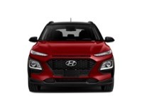 2018 Hyundai Kona 2.0L Luxury (A6) Exterior Shot 5