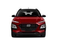 2018 Hyundai Kona 2.0L Luxury (A6) Exterior Shot 5