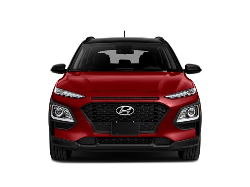 2018 Hyundai Kona 2.0L Luxury (A6) Exterior Shot 5