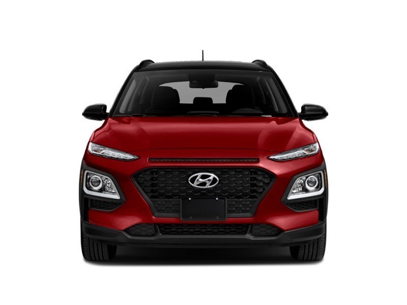 2018 Hyundai Kona 2.0L Luxury (A6) Exterior Shot 5