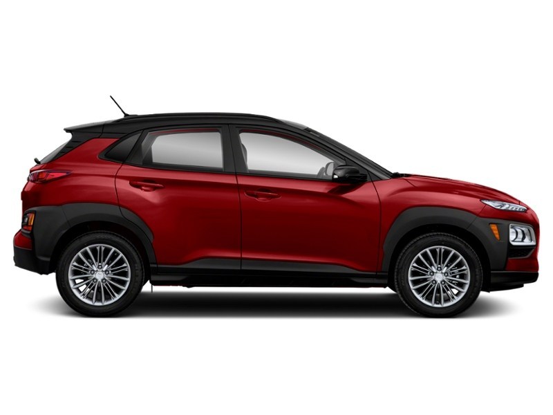 2018 Hyundai Kona 2.0L Luxury (A6) Exterior Shot 10